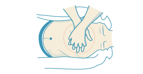 Cardiopulmonary Rescuscitation 